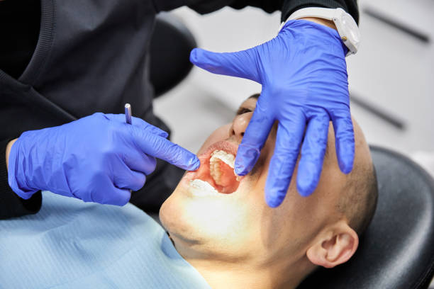 Best Knocked-Out Tooth (Avulsed Tooth) Treatment in Livingston, CA
