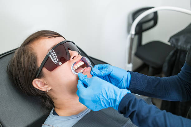 Best Knocked-Out Tooth (Avulsed Tooth) Treatment in Livingston, CA